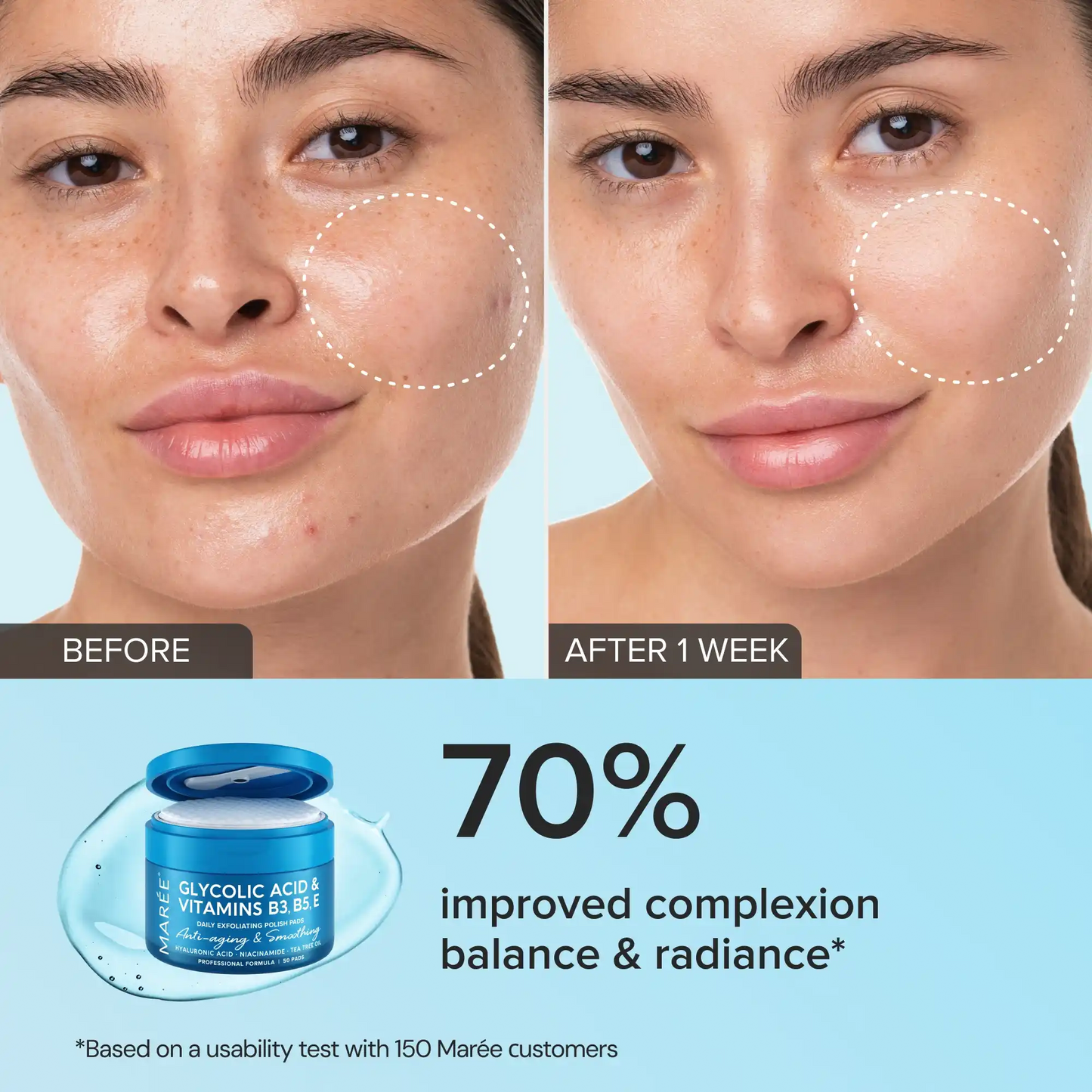 Glycolic Acid Exfoliating Pads
